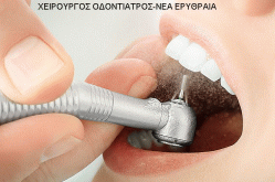 ΜΟΝΟ 18€ καθαρισμός δοντιών που περιλαμβάνει αφαίρεση πέτρας & πλάκας με χρήση υπερήχων, στίλβωση και σοδοβολή (όπου απαιτείται) από σύγχρονο Οδοντιατρείο στην Νέα Ερυθραία. Ο καθαρισμός των δοντιών μας είναι ανώδυνη & απλή διαδικασία & αποτελεί μία θεραπευτική και προληπτική διαδικασία για υγιή και όμορφα δόντια.